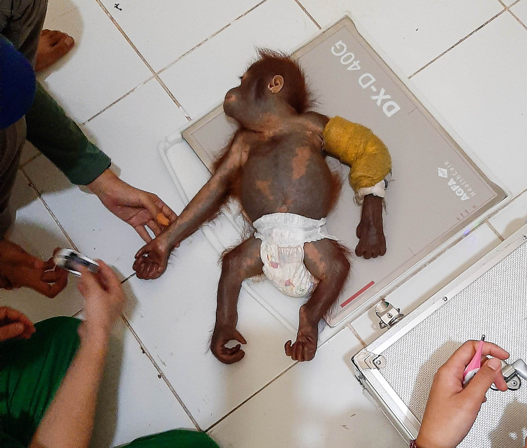 Ein Orang-Utan Baby wird medizinisch behandelt.